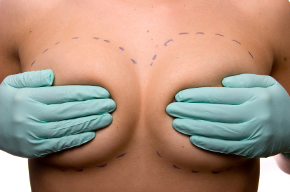 implantes de senos